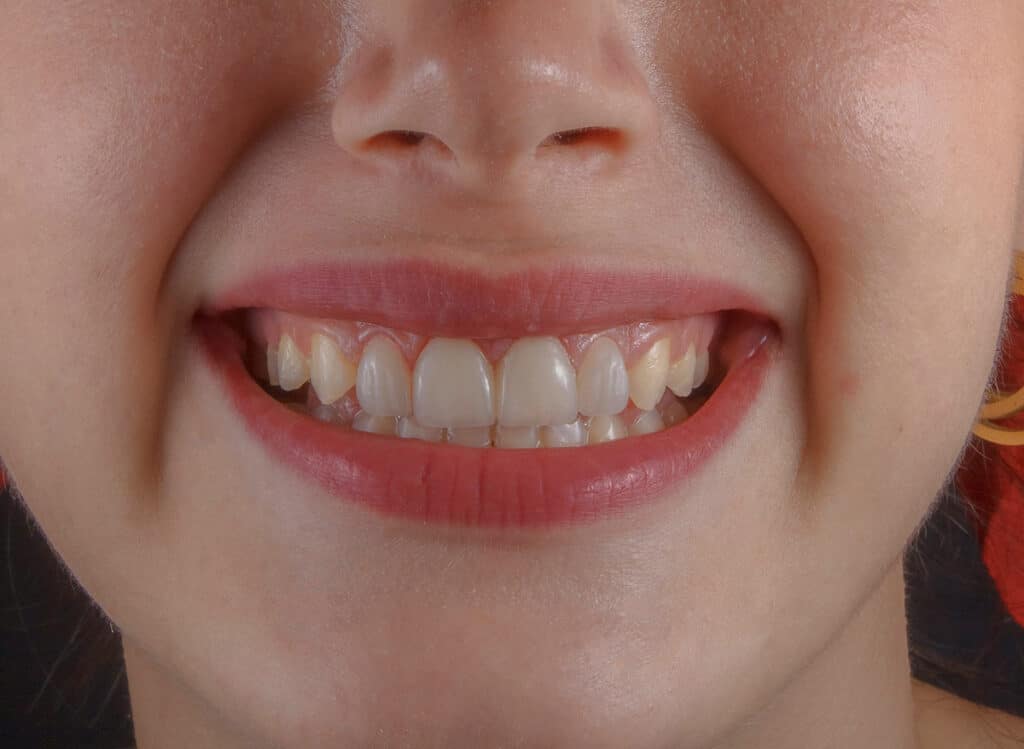 Tænder